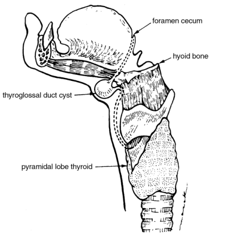 thyroglossal-duct (1)