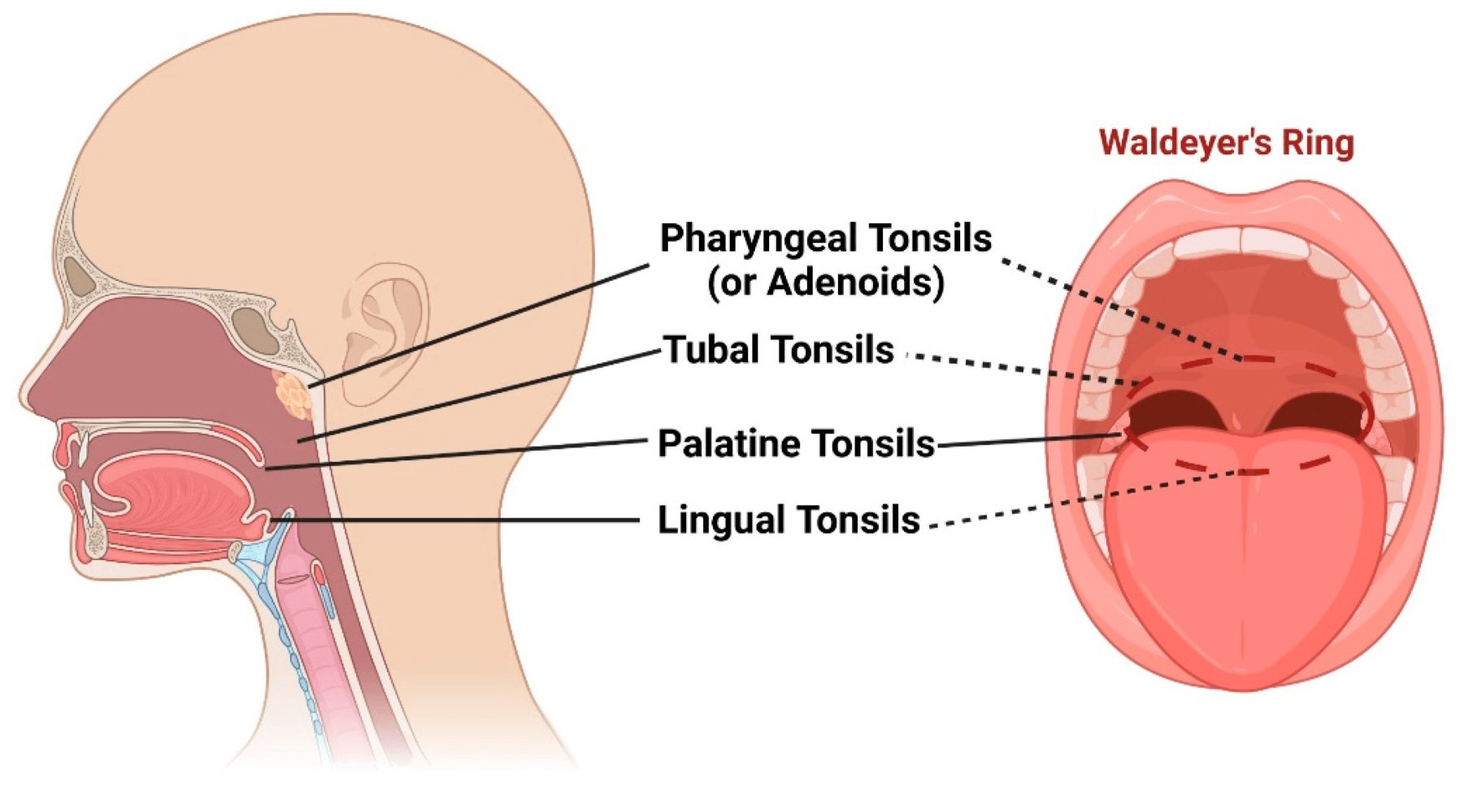 tonsils adenoids medical diagram showing tonsils and adenoids