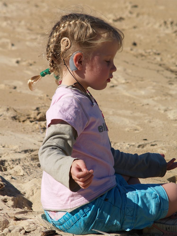 Cochlear Implant2