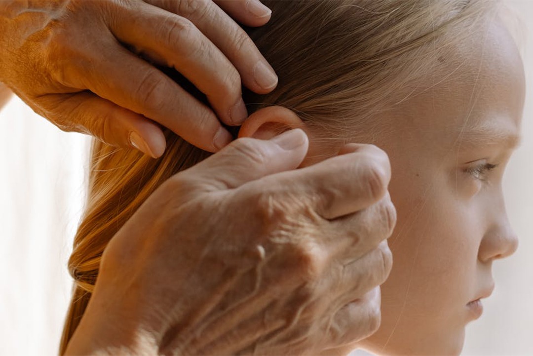 Cochlear Implant5